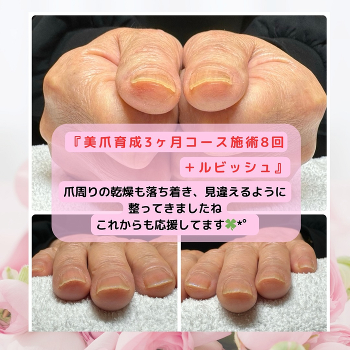 画像241